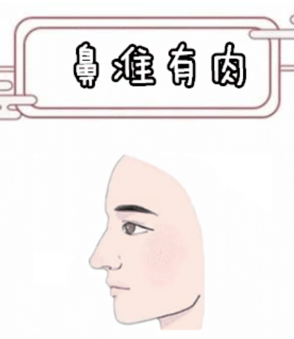 图片[2]-算命的说：面相有一处，一长肉就发达，婚后走大运，一生富足！