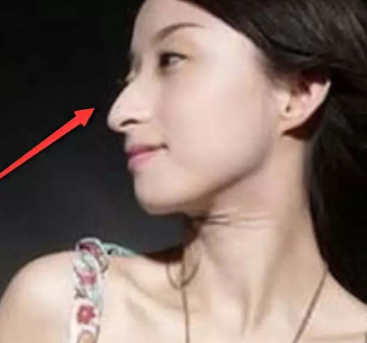 图片[3]-五种不可交的朋友面相分析，心术不正，是个沾光笑的小人！