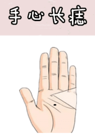 图片[2]-身体5颗“抓财”痣，男抓金，女抓银，有车有房，有钱有权！