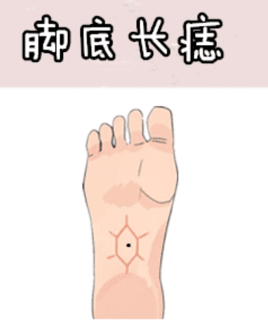 图片[3]-身体5颗“抓财”痣，男抓金，女抓银，有车有房，有钱有权！