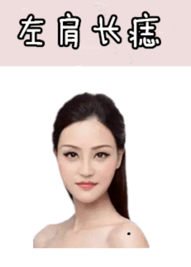 图片[4]-身体5颗“抓财”痣，男抓金，女抓银，有车有房，有钱有权！