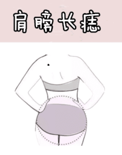 图片[5]-身体5颗“抓财”痣，男抓金，女抓银，有车有房，有钱有权！