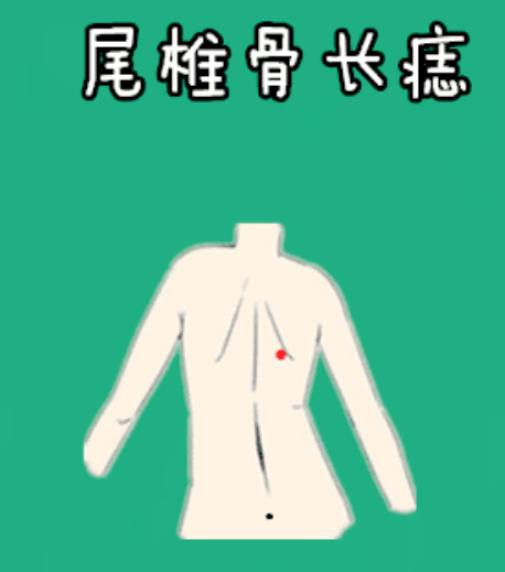 图片[2]-身体5颗“福禄”痣，一个添富，一个增权，十有八九不差钱！