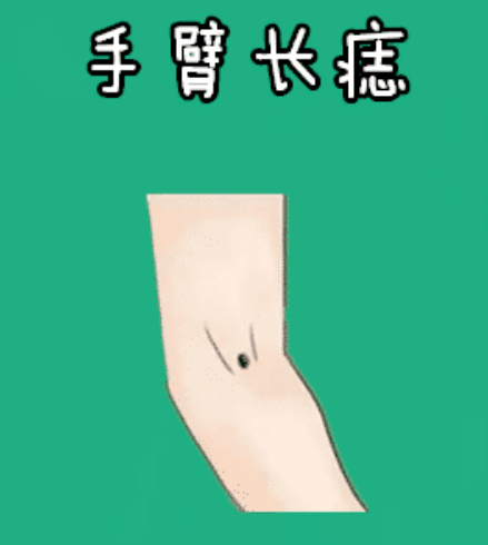 图片[3]-身体5颗“福禄”痣，一个添富，一个增权，十有八九不差钱！