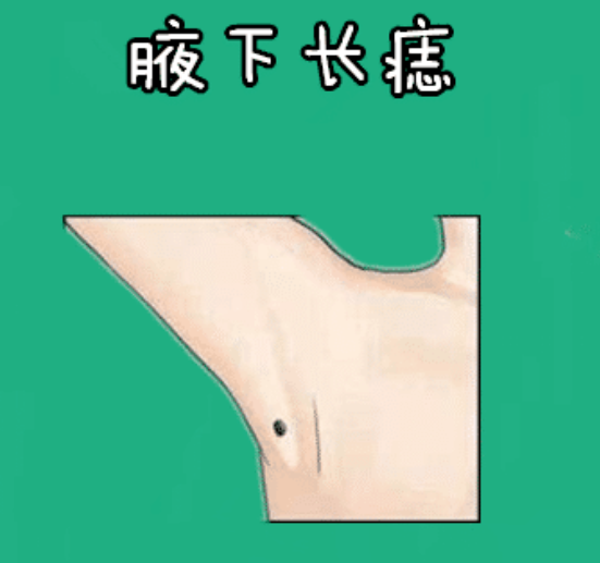 图片[5]-身体5颗“福禄”痣，一个添富，一个增权，十有八九不差钱！