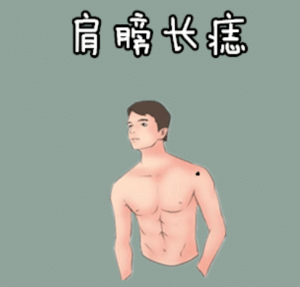 身体4颗“穷”痣,看见就点掉,破财,耗运气!-道一卦