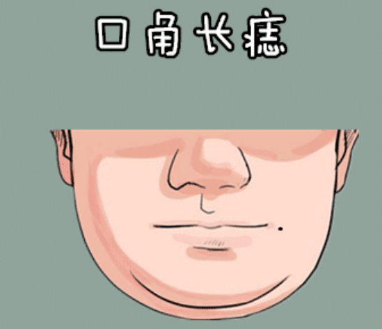 图片[4]-身体4颗“穷”痣，看见就点掉，破财，耗运气！