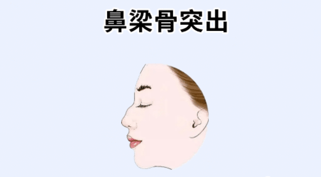 图片[3]-四种“坏人”面相，自私自利，心肠狠毒，坑穷别人富自己！