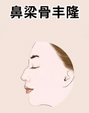 图片[2]-五种一夜暴富的面相，婚后走大运，车房不愁，前途一片光明！